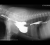Imagen: core_media/myramar/casos clinicos/arco aortico/1_arco_aortico.jpg